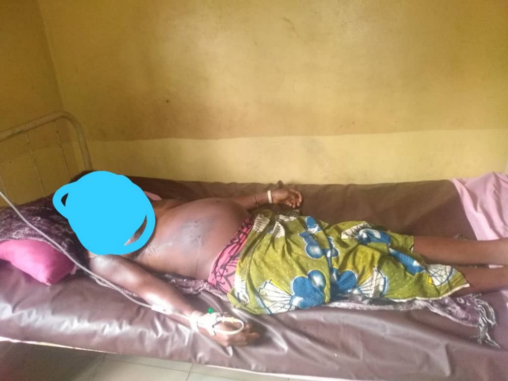 Girl 18, Baths Pregnant Brother’ s  Wife With Hot Water And Pepper In Awka