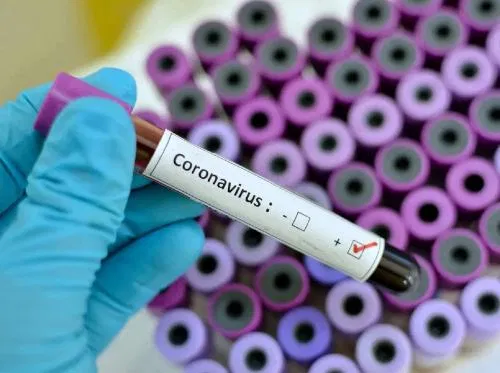 Commentary: Coronavirus – A Crystal Reality, Stay Safe